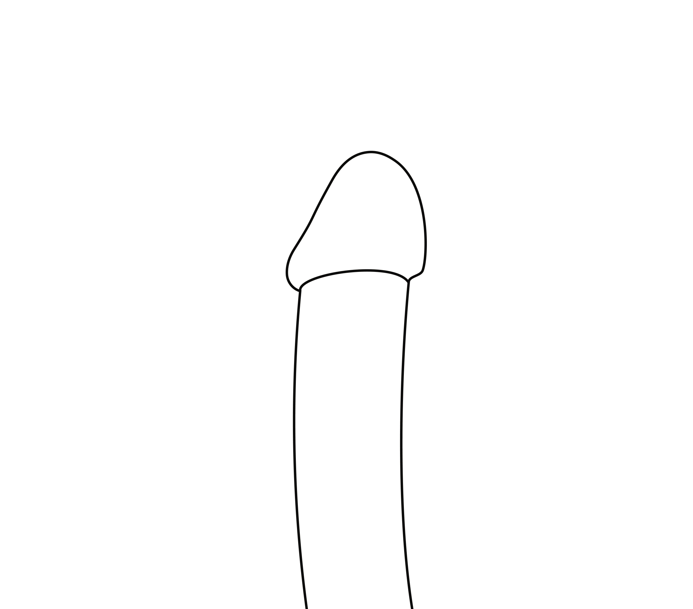animation showing the results of WIDR penile girth enhancement