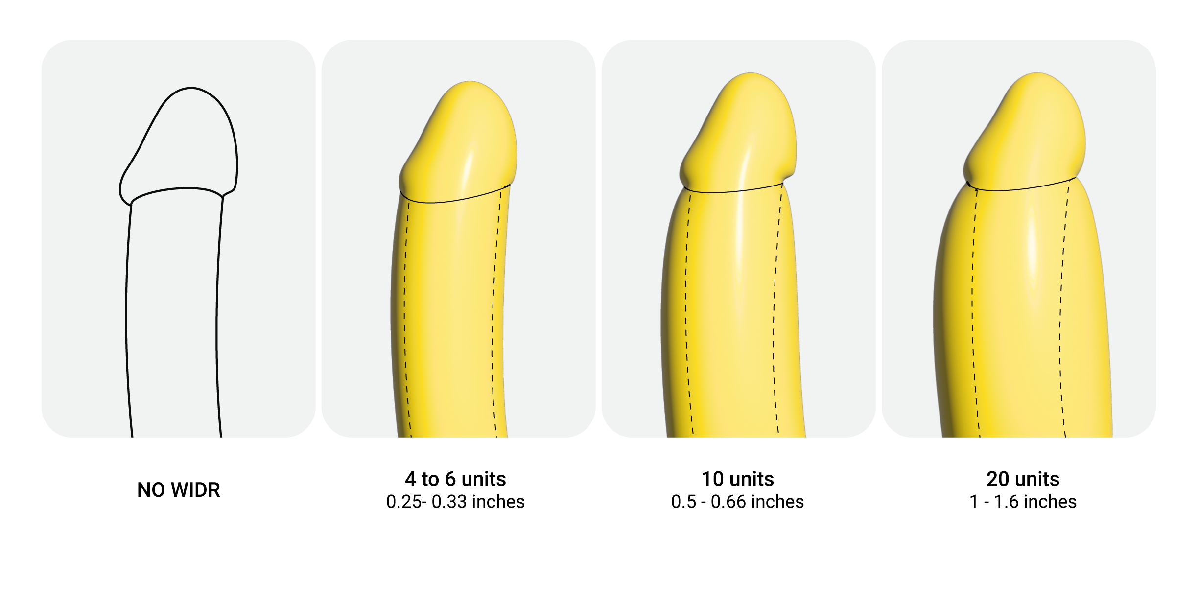 graphical representation of the results of the WIDR penile enhancement treatment